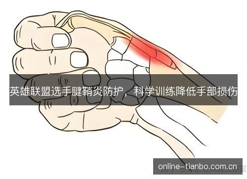 英雄联盟选手腱鞘炎防护，科学训练降低手部损伤